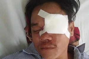 'Tín dụng đen' đâm mù mắt người vay nợ không có tiền trả