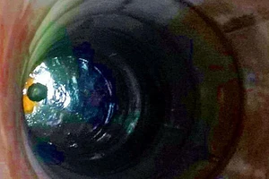 Nghi ngáo đá cố thủ... dưới giếng hơn 3 giờ