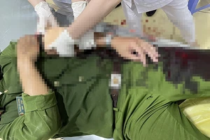 Thanh niên vi phạm phòng dịch, chém thượng úy cảnh sát trọng thương 