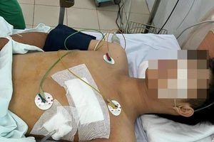 Cứu sống thiếu niên 16 tuổi bị đâm thủng tim, thủng phổi 