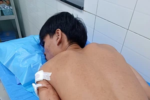  Nam sinh lớp 11 ở Phan Thiết bị nhóm thanh niên đâm gục trước cổng trường