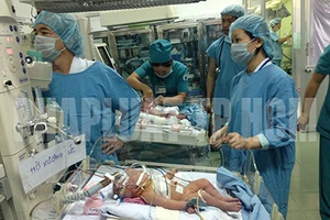 Tách thành công hai bé dính nhau