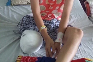 Vụ nữ sinh bị cưa cụt chân: Bộ Y tế yêu cầu làm rõ