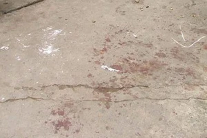 Chém người để cướp giỏ tiền ở chợ Bình Tây