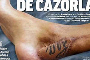 Đau lòng vết thương bị hoại tử của sao Arsenal