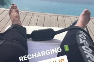 Fan sốc và bàng hoàng khi Ronaldo ‘khoe chân’