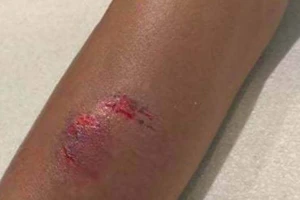 Nữ hành khách cắn nhân viên Jetstar Pacific