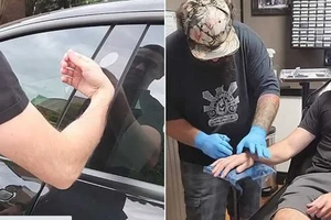 Chủ sở hữu Tesla cấy chip vào tay để mở ô tô 