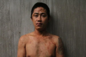 Bắt giam người say dùng mảnh kính tấn công công an TP Thủ Đức