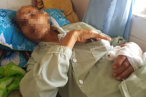 Người cha bị con cháu đánh nguy kịch vì định bán đất chữa bệnh