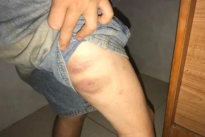 Công an xác minh vụ bé trai bị cha, bà nội đánh đập