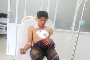 Đi đánh cá, 2 thanh niên bị thương nặng do mìn tự chế phát nổ