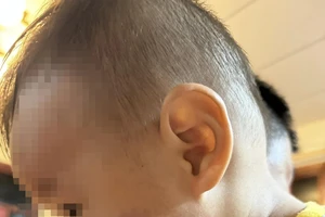 Tạm đình chỉ cơ sở mầm non tư thục nghi bạo hành trẻ ở Bình Định