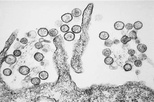 Đài Loan ghi nhận ca mắc virus Hanta thứ hai, sau ca tử vong đầu tiên