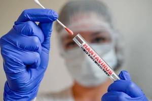 Tại sao dịch virus Hanta khác COVID-19?