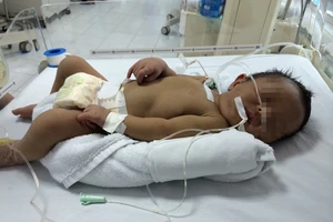 Cứu sống cháu bé mắc bệnh vàng da sơ sinh hiếm gặp
