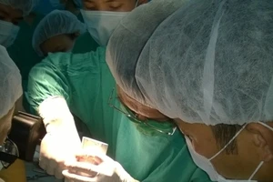 BV đa khoa tỉnh Thừa Thiên – Huế tiếp nhận công nghệ chữa bệnh mới