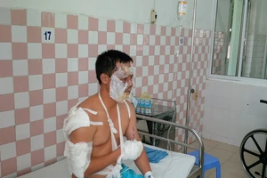 Cháy nổ lớn trong kho hóa chất, 17 chiến sĩ PCCC bị thương