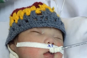 Bệnh nhi vừa chào đời phải mổ cắt khối u khổng lồ