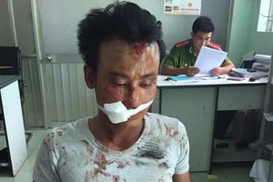 ‘Ngáo đá’ cầm dao chém người liên tiếp