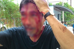 Lời kể của cư dân chung cư 4S bị đánh chấn động não