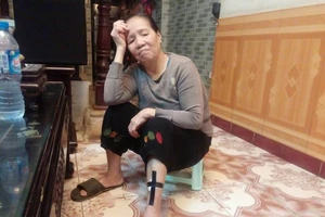 Luật sư phân tích pháp lý trong vụ 4 con chó lao vào cắn chủ