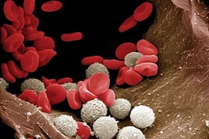 Bình Phước công bố dịch bạch hầu ở huyện Đồng Phú