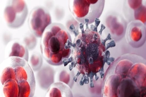 Mỗi năm Việt Nam có 150.000 người chết vì ung thư