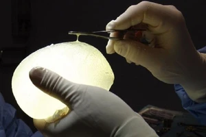 Trả 64 triệu USD cho 20.000 phụ nữ nâng ngực bị lỗi