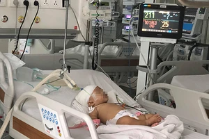 Mối nguy từ thú nuôi cưng là động vật hoang dã