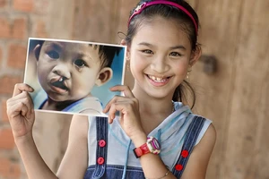 Tiến Phước Group giúp gần 60 trẻ hở hàm ếch tìm lại nụ cười trọn vẹn