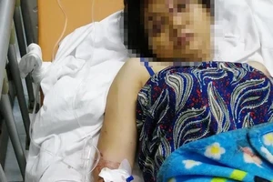 Khởi tố, bắt giam kẻ đánh đập, tra tấn dã man cô gái 18 tuổi