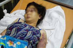 Vụ cô gái bị tra tấn đến sẩy thai: Khởi tố bị can thứ ba