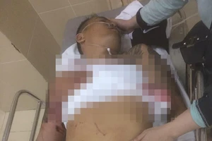 Truy bắt nhóm thanh niên bịt mặt, nổ súng vào quán cà phê 