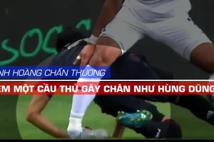 Một cầu thủ trẻ gãy chân kinh hoàng như Đỗ Hùng Dũng