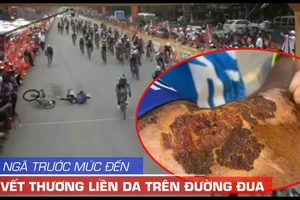 Đời cua rơ té đau, đứng dậy và vết thương chưa liền da...