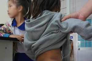 Công an TP Cà Mau báo cáo nhanh vụ 4 trẻ em bị bạo hành