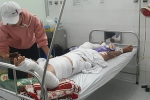 Cà Mau: Nổ ghe lưới ghẹ, 3 ngư dân bị thương