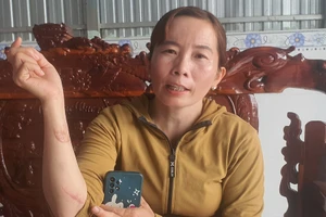 Vụ người cắn người ở Cà Mau: Không khởi tố tội xâm phạm chỗ ở