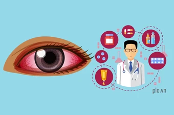 5 thắc mắc thường gặp khi bị đau mắt đỏ