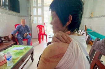 Phòng, chống bạo lực gia đình: Nạn nhân cần lên tiếng!