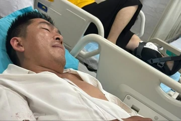 1 thẩm phán ở Lâm Đồng bị chém trọng thương