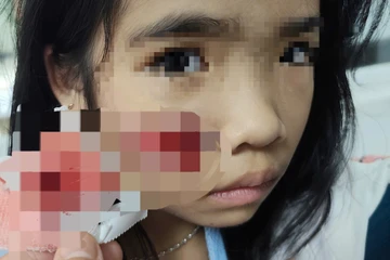 Đang chơi ở sân nhà thì bị khỉ hoang lao vào tấn công