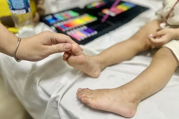 Chăm sóc trẻ mắc tay chân miệng tại nhà 