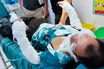 Dùng bình gas thui thịt chó, 2 người đàn ông bị bỏng 38% cơ thể 