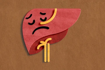  7 dấu hiệu cảnh báo gan đang tổn thương dù bạn không hề uống rượu