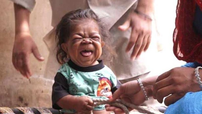 Kỳ lạ chàng thanh niên 23 tuổi trong hình hài em bé 1 tuổi