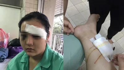 Phó thủ tướng yêu cầu điều tra vụ 'cắt tai thiếu nữ’