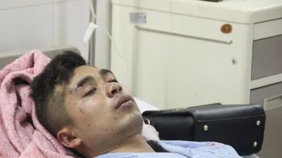 Nạn nhân trên xe khách nổ kể lại giây phút kinh hoàng 