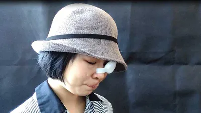 Nữ sinh bị tạt acid: ‘Em từng rất tuyệt vọng’